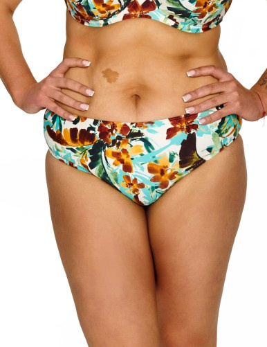 Figi bikini Gaia 1 Lupoline – wysoki stan i wygodny fason